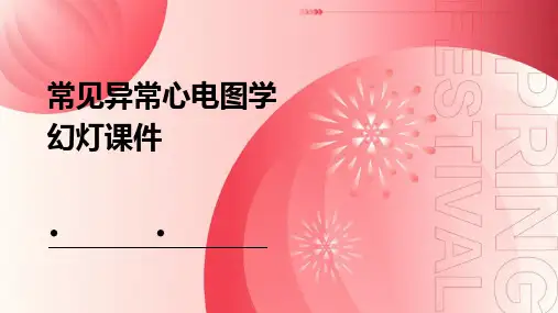 常见异常心电图学幻灯课件
