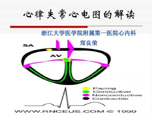 5.心律失常的ECG分析判读.ppt