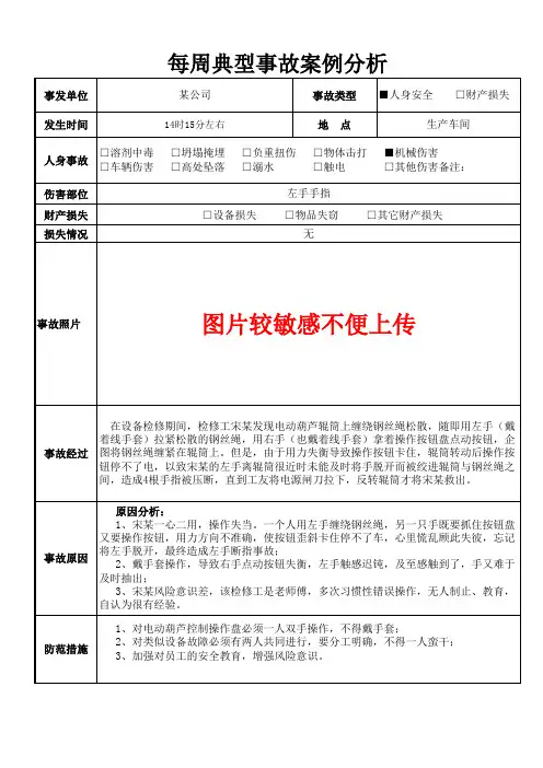 某公司员工一心二用电动葫芦绞断手指事故