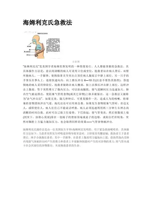 海姆利克氏急救法
