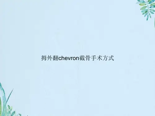 拇外翻chevron截骨手术方式
