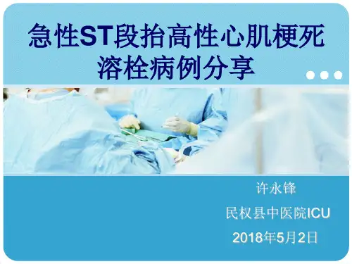 急性心肌梗死溶栓病例