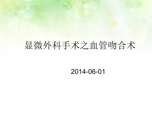 血管吻合术