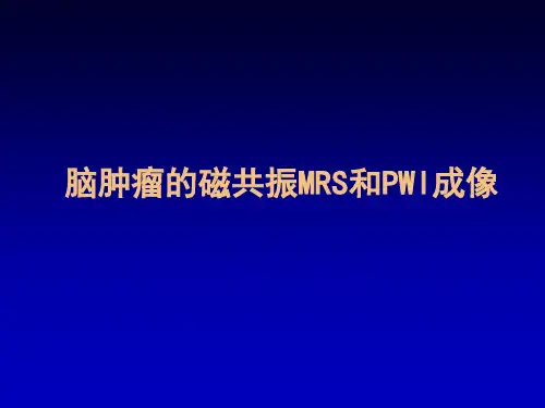 脑肿瘤磁共振波谱MRS和PWI灌注成像PPT课件