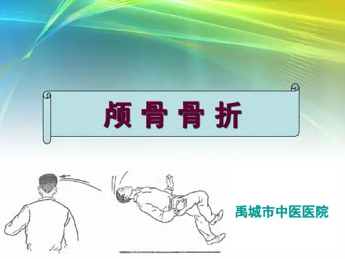 颅骨骨折的规范治疗