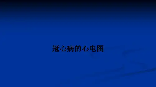 冠心病的心电图PPT课件