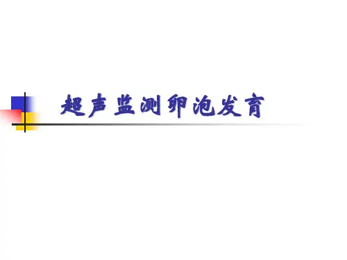 超声检测卵泡发育