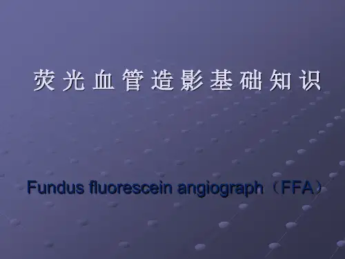 荧光血管造影.
