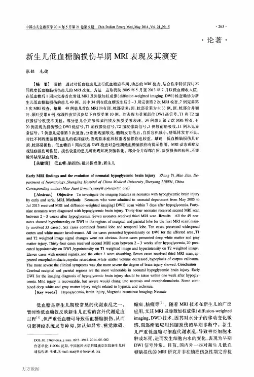新生儿低血糖脑损伤早期MRI表现及其演变