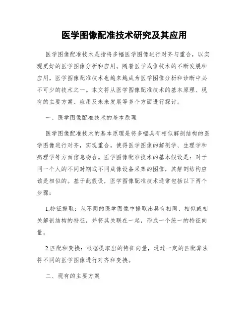 医学图像配准技术研究及其应用