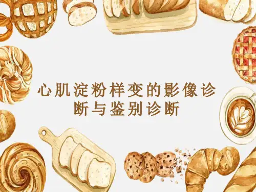 心肌淀粉样变的影像诊断与鉴别诊断