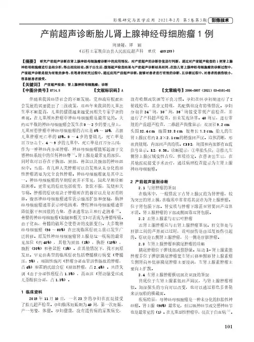 产前超声诊断胎儿肾上腺神经母细胞瘤1例