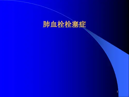 肺栓塞ppt课件