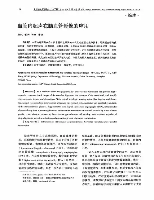 血管内超声在脑血管影像的应用