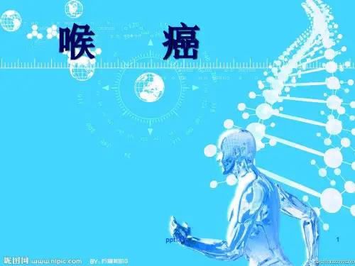 喉癌  ppt课件