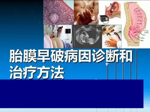 胎膜早破病因诊断和治疗方法PPT课件