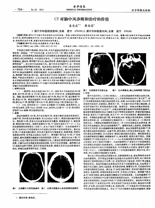 CT对脑中风诊断和治疗的价值