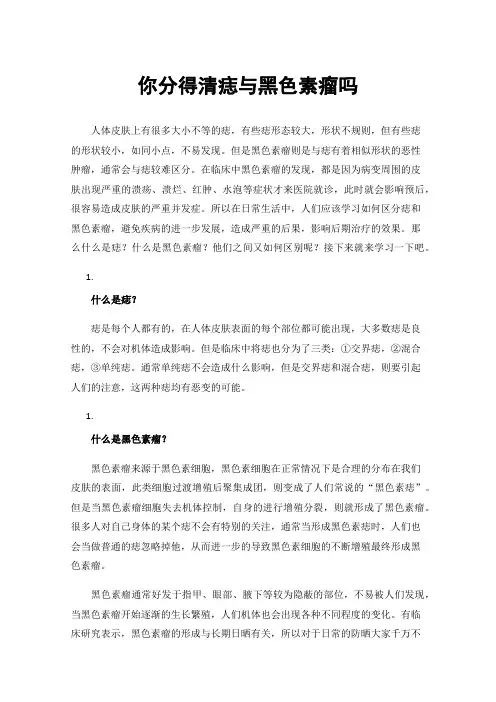 你分得清痣与黑色素瘤吗
