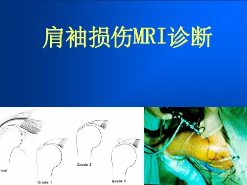 肩袖损伤MRI诊断80885PPT课件