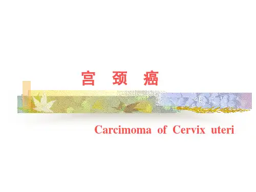 宫颈癌
