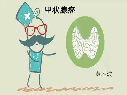 甲状腺癌