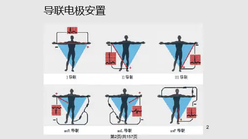 心电图的阅读方法正式