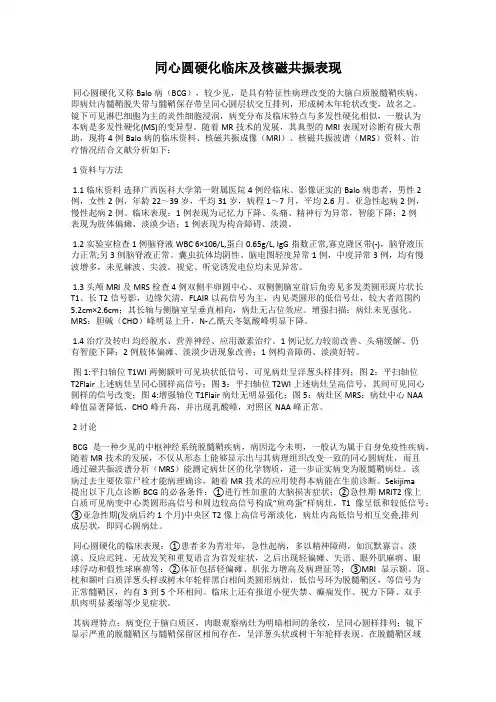 同心圆硬化临床及核磁共振表现