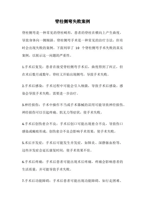 脊柱侧弯失败案例