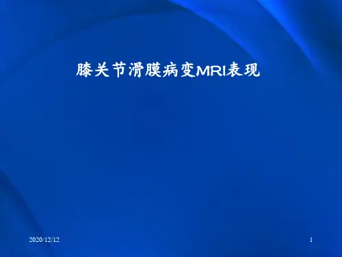 膝关节滑膜病变MRI ppt课件