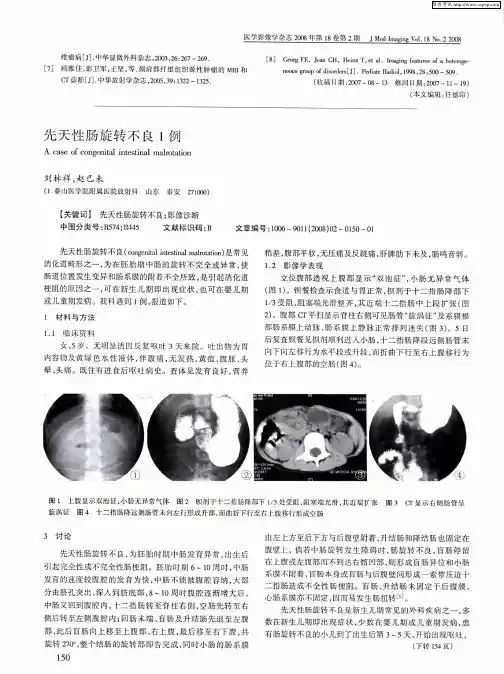 先天性肠旋转不良1例