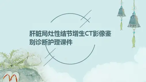 肝脏局灶性结节增生CT影像鉴别诊断护理课件