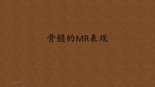 骨髓的MR表现 ppt课件