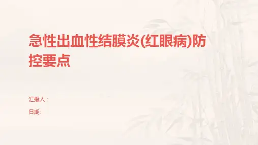 急性出血性结膜炎(红眼病)防控要点