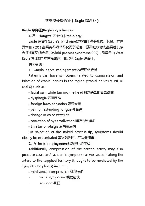 茎突过长综合征（Eagle综合征）