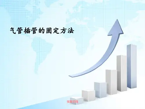 气管插管的固定方法 