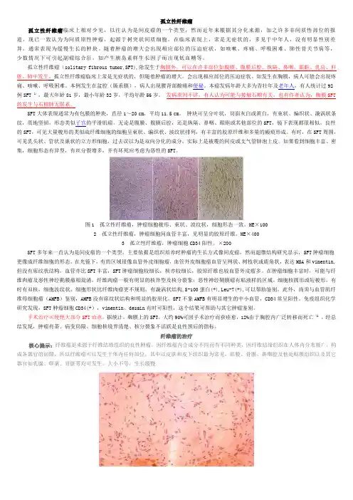 孤立性纤维瘤