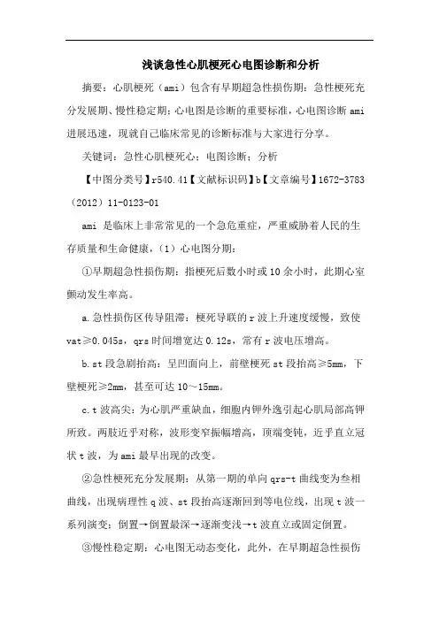 急性心肌梗死心电图诊断和论文