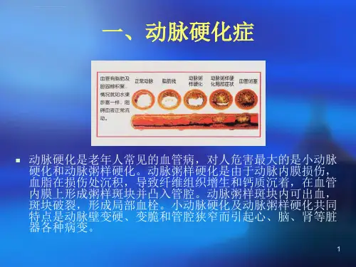 心脑血管病的防治ppt课件