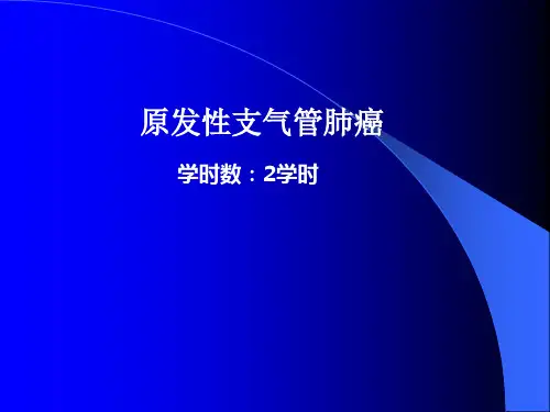 内科学课件：原发性支气管肺癌
