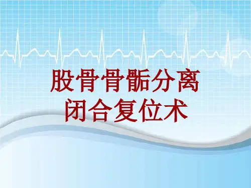 手术讲解模板：股骨骨骺分离闭合复位术