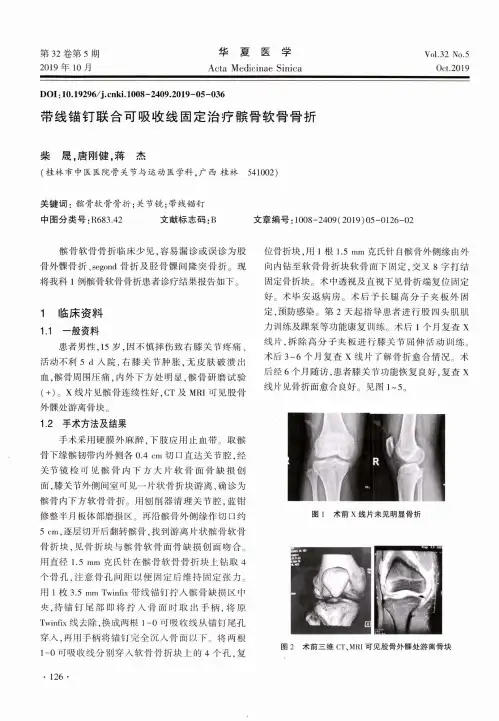 带线锚钉联合可吸收线固定治疗髌骨软骨骨折