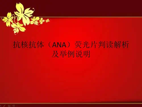 课件：抗核抗体(ANA)荧光模型判读解析及举例说明