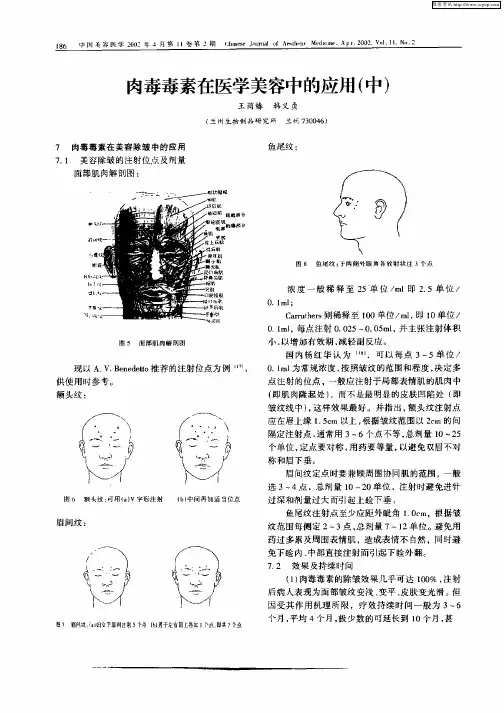 肉毒毒素在医学美容中的应用(中)