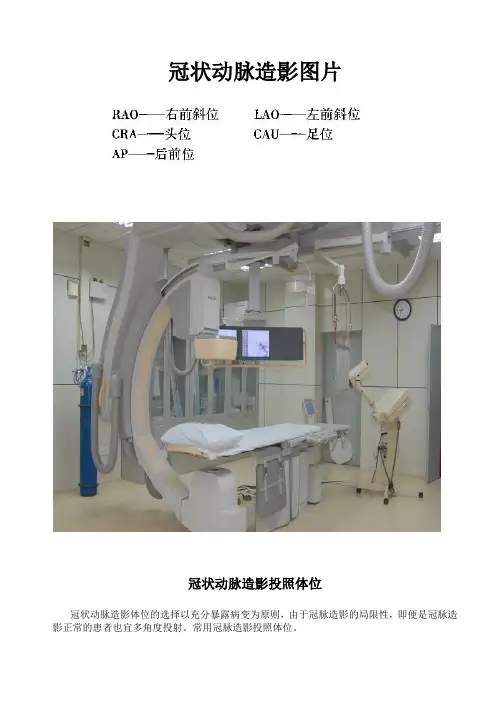 冠状动脉造影体位图片