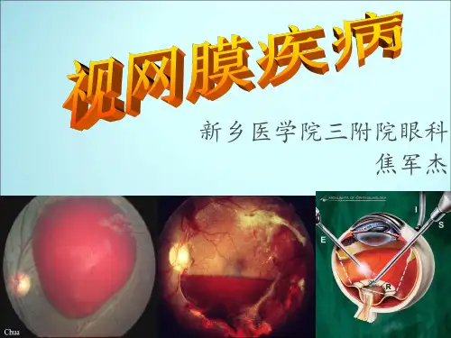 视网膜病ppt课件