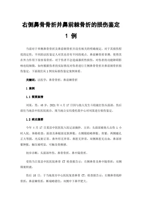右侧鼻骨骨折并鼻前棘骨折的损伤鉴定1例