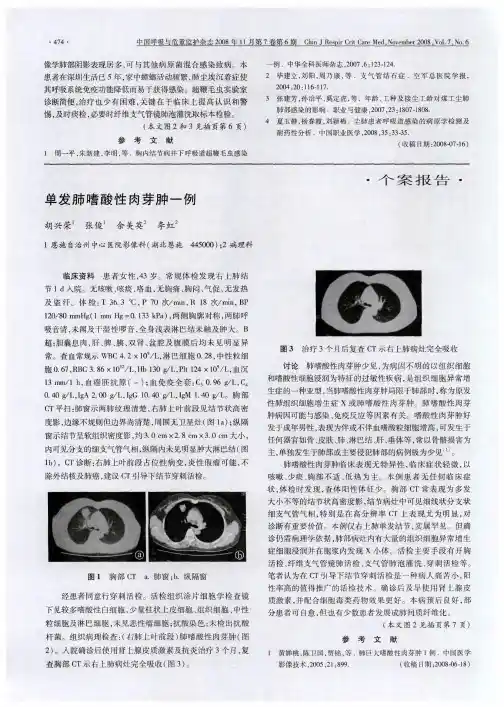 单发肺嗜酸性肉芽肿一例