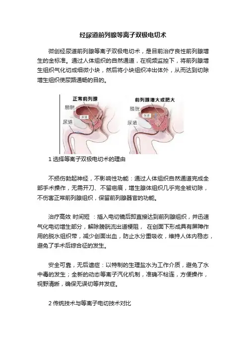 经尿道前列腺等离子双极电切术