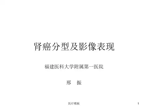 肾癌分型及影像表现[仅供参考]