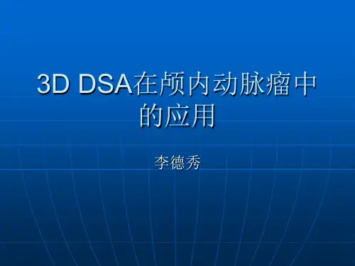 3DDSA在颅内动脉瘤中的应用(精)